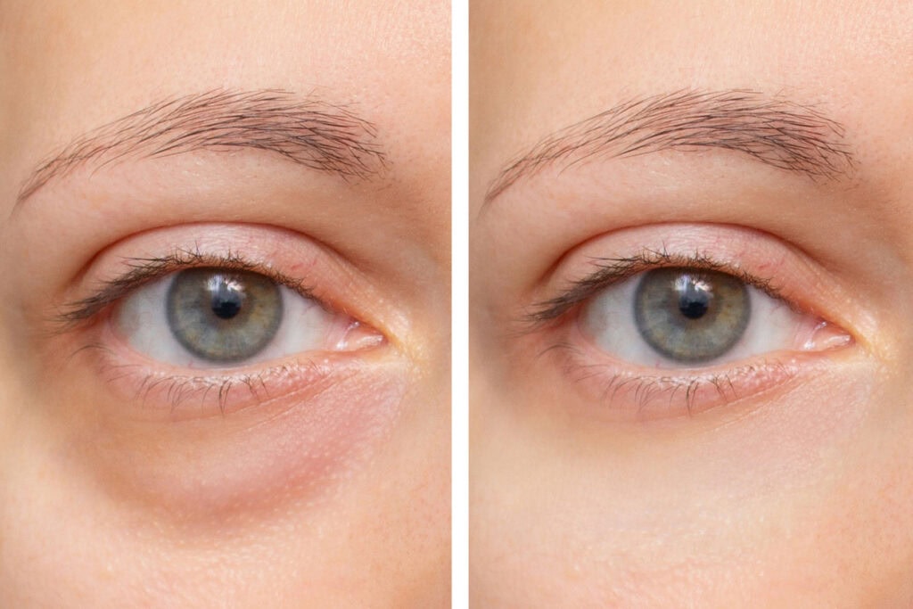 tauranga eye specialists ophthalmologists eye care services 106