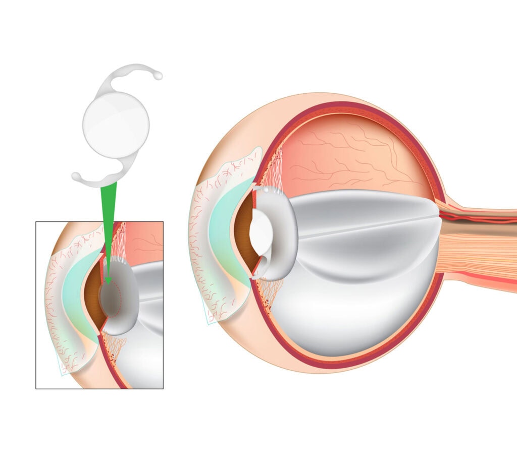 tauranga eye specialists ophthalmologists eye care services 120